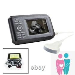 Handheld Ultrasound Scanner Machine Digital+Convex Probe For Human Carejoy