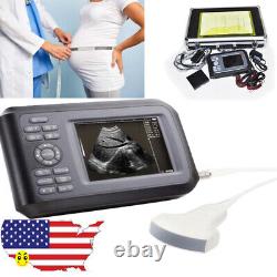 Handheld Ultrasound Scanner Machine Digital+Convex Probe For Human Carejoy