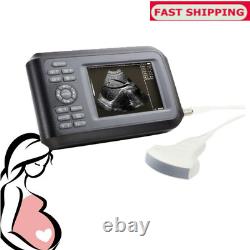 Handheld Ultrasound Scanner Machine Digital+Convex Probe For Human Carejoy