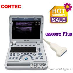 Hot Digital Ultrasound Scanner 7.5MHz Linear Probe Laptop B-Ultrasound Machine