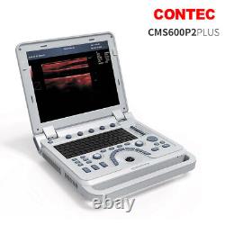 Hot Digital Ultrasound Scanner 7.5MHz Linear Probe Laptop B-Ultrasound Machine