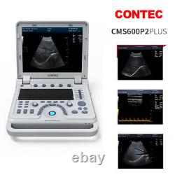 Hot Digital Ultrasound Scanner 7.5MHz Linear Probe Laptop B-Ultrasound Machine