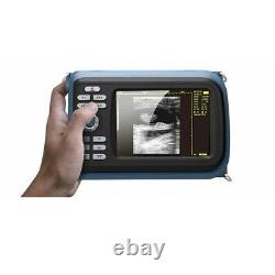 Human 5.5'' Handheld Ultrasound Machine Scanner Digital+Convex Probe Box NEW