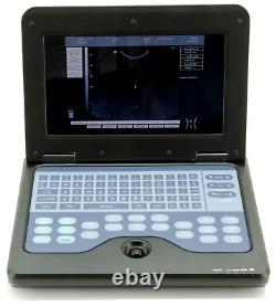 Human Portable CMS600P2 Laptop Ultrasound Scanner Machine 3.5M Convex Probe USA