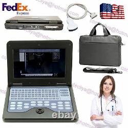 Human Portable Laptop Machine Digital Ultrasound Scanner, 3.5MHZ Convex probe USA