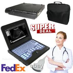 Laptop Ultrasound Machine, Notebook Digital Ultrasound Scanner, 3.5 Convex probe