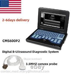 Laptop Ultrasound Scanner 3.5 Convex Abdominal Probe Digital Diagnostic