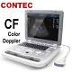 Laptop Ultrasound Scanner Color Doppler Digital Machine Convex Probe Pwith Cf Ce