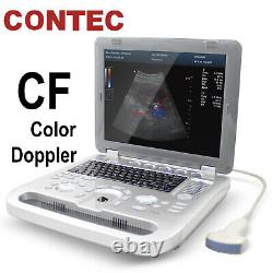 Laptop Ultrasound Scanner Color Doppler Digital Machine Convex Probe PWith CF CE
