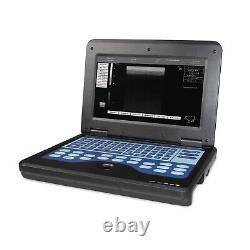 Laptop machine Digital Ultrasound scanner with 2 probes, convex linear