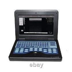 Laptop machine Digital Ultrasound scanner with 2 probes, convex linear