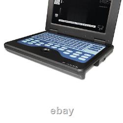 Laptop machine Digital Ultrasound scanner with 2 probes, convex linear