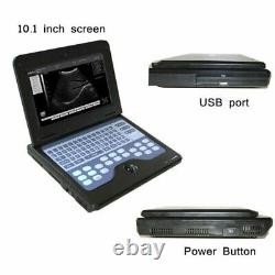 Laptop machine Digital Ultrasound scanner with 2 probes, convex linear