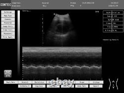 Laptop machine Digital Ultrasound scanner with 2 probes, convex linear