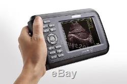 Mini Handheld 5.5'' LCD Digital Ultrasound Scanner System Convex Transvaginal CE