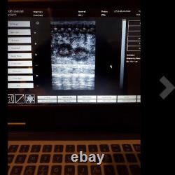 NEW CE FDA Promotion B-ultrasound ultrasound Scanner ultrasound machine 3 probes
