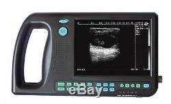 NEW CMS600S Digital Portable PalmSmart Ultrasound Scanner machine w Convex probe