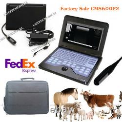 NEW Laptop Veterinary Ultrasound Scanner Portable Machine+7.5Mhz Rectal Probe, US