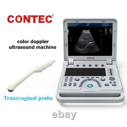 New Color Doppler Ultrasound Scanner Machine CF PW Transvaginal Probe CMS1700A
