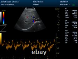 New Color Doppler Ultrasound Scanner Machine CF PW Transvaginal Probe CMS1700A