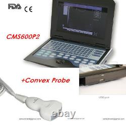 New Portable Digital Medical Ultrasound Scanner Machine Convex Probe, US Seller