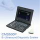 Notebook Ultrasound Scanner Digital Laptop Machine 3.5mhz Convex Probe Cms600p