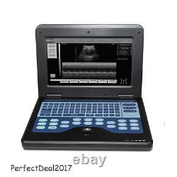 Notebook Ultrasound Scanner Laptop Machine CMS600P2+7.5Mhz Linear Probe, US Fedex
