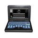 Only Digital Ultrasound Scanner Portable Laptop Machine No Probe