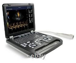 Portable Cardiac Heart Ultrasound Scanner Color Doppler Machine Phased Array PW