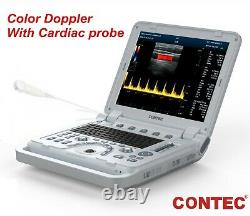 Portable Color Doppler Ultrasound Scanner Machine Heart Exam Cardiac MicroConvex