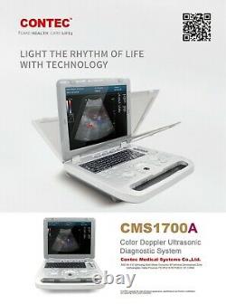 Portable Color Doppler Ultrasound Scanner Machine Heart Exam Cardiac MicroConvex