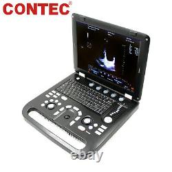 Portable Color Doppler Ultrasound Scanner Machine Heart Exam Cardiac MicroConvex