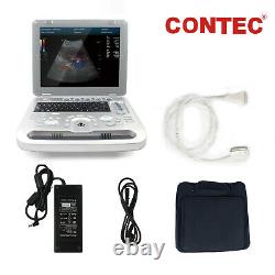 Portable Color Doppler Ultrasound Scanner Machine Heart Exam Cardiac MicroConvex