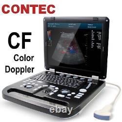 Portable Color Doppler laptop Digital Ultrasound Scanner machine CONTEC