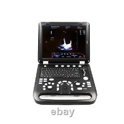 Portable Color Doppler laptop Digital Ultrasound Scanner machine CONTEC