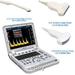 Portable Color Ultrasound Scanner Color Doppler Linear/Convex/Vaginal 3 Probes