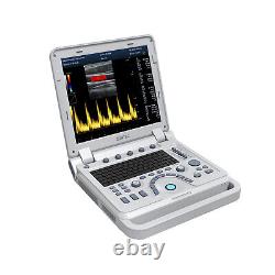 Portable Color Ultrasound Scanner Color Doppler Linear/Convex/Vaginal 3 Probes