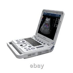 Portable Color Ultrasound Scanner Color Doppler Linear/Convex/Vaginal 3 Probes