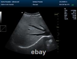 Portable Color Ultrasound Scanner Color Doppler Linear/Convex/Vaginal 3 Probes