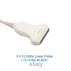 Portable Color Ultrasound Scanner Color Doppler Linear/Convex/Vaginal 3 Probes