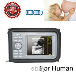 Portable Digital Handheld Human Ultrasound Scanner Machine 3.5mhz Convex Probe