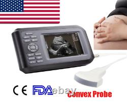 Portable Digital Handheld Ultrasound Scanner Machine System+Convex Probe FDA/CE