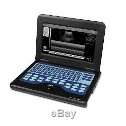 Portable Digital Ultrasound Scanner Laptop Machine+3.5M Convex Probe+Bag CE Hot