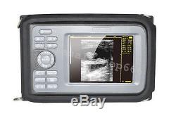 Portable Handheld Digital Ultrasound HandScan Scanner Convex Probe Obstetrics CE