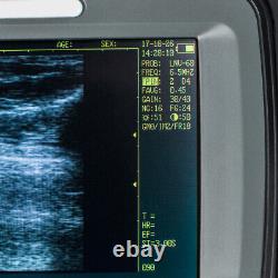 Portable Handheld Digital Ultrasound Scanner Machine Rectal Probe Veterinary New