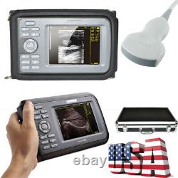 Portable Handheld Digital Ultrasound Scanner Monitor Convex Probe for human Tool