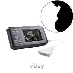 Portable Handheld Ultrasound Scanner/Machine Digital +Convex Probe For Human