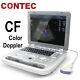 Portable High Resolution Color Doppler Ultrasound Scanner With Convex Probe New