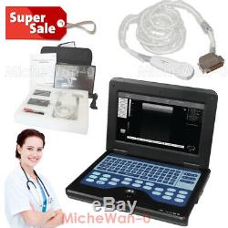 Portable Laptop Machine Digital Ultrasound Scanner, 3.5 Micro-convex Probe, Heart