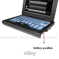 Portable Laptop Machine Digital Ultrasound Scanner, 3.5M Convex+Cardiac 2 Probes